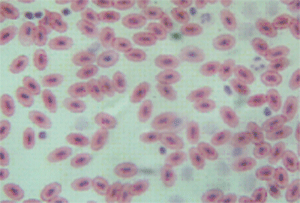 Кровь Под Микроскопом Фото